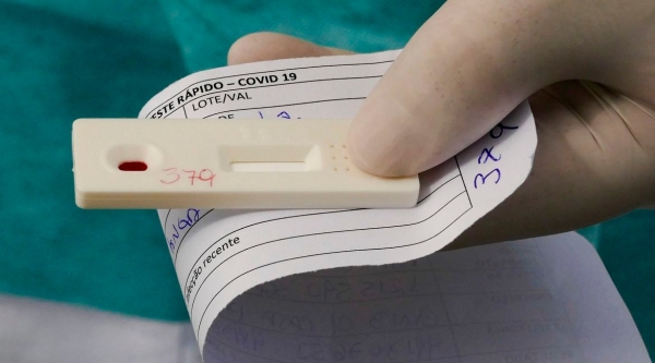 O exame diagn�stico previsto pela ANS � o do tipo pesquisa por RT ? PCR, com diretriz de utiliza��o, e deve ser feito em pacientes considerados quadro suspeito ou prov�vel da doen�a, de acordo com a indica��o m�dica (Foto: Leopoldo Silva/Ag�ncia Senado).