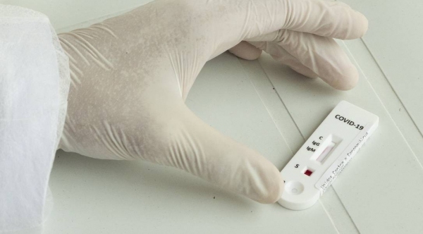 Testes so realizados a partir de amostra de sangue (Foto: Agncia Brasil).