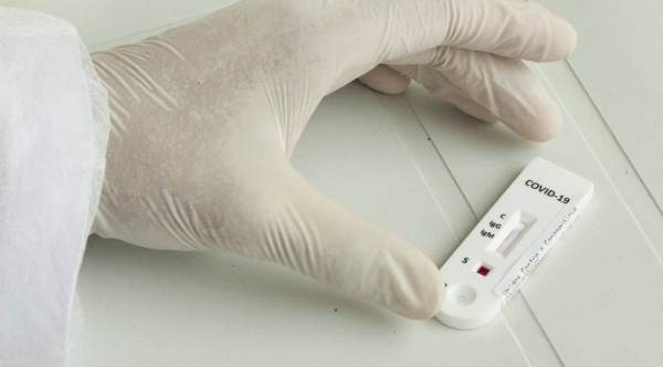 Testes s�o realizados a partir de amostra de sangue (Foto: Ag�ncia Brasil).